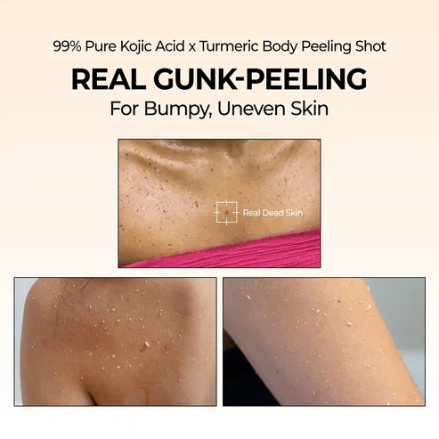 Peel Shot Spray – Instant Skin Brightening & Dark Spot Remover (Kojic Acid + Turmeric)