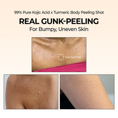 Peel Shot Spray – Instant Skin Brightening & Dark Spot Remover (Kojic Acid + Turmeric)