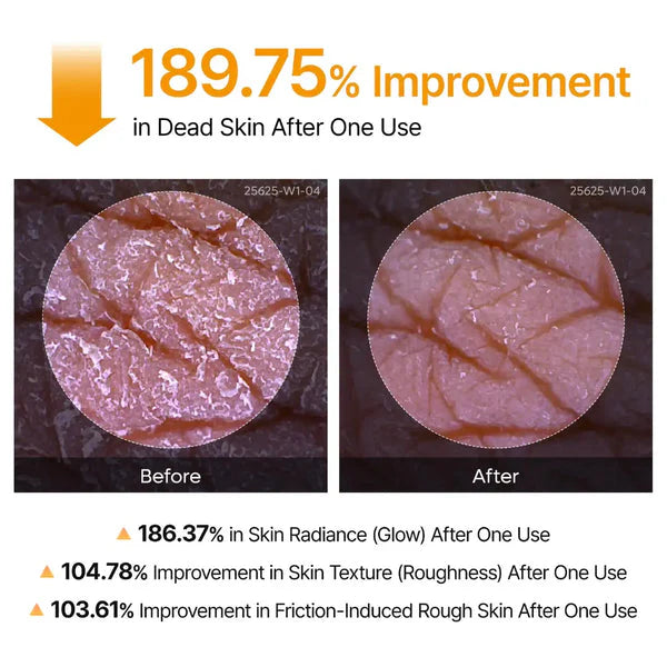 Peel Shot Spray – Instant Skin Brightening & Dark Spot Remover (Kojic Acid + Turmeric)