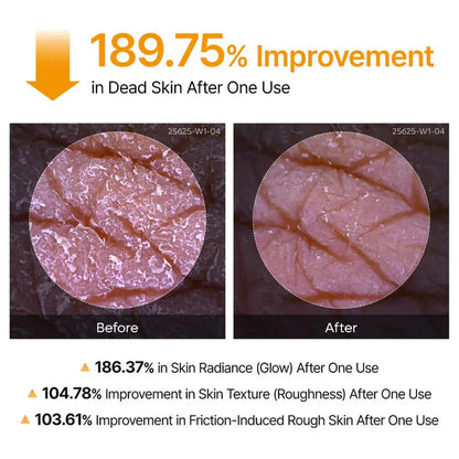Peel Shot Spray – Instant Skin Brightening & Dark Spot Remover (Kojic Acid + Turmeric)